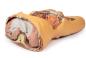 Preview: Posteriore Abdominalwand