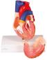 Preview: Erler Zimmer - Herzmodell, natürliche Größe, 2 Teile - EZ Augmented Anatomy