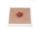 Preview: Erler Zimmer - Wundmoulage Ileostoma, inkl. Stativ
