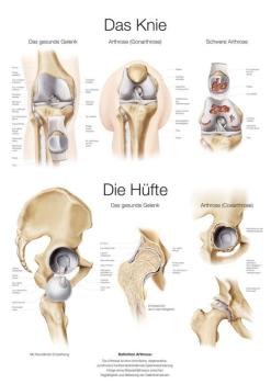 Lehrtafel "Das Knie / Die Hüfte", 70x100cm
