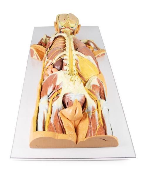 Präparat des Nervensystems (posteriore Ansicht)