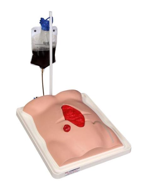 Erler Zimmer - Freddie Fistula Übungsmodell mit Koffer