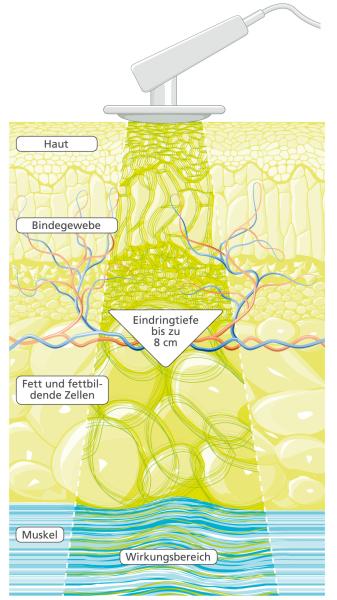 PHYSIOMED DEEP OSCILLATION® Personal BASIC